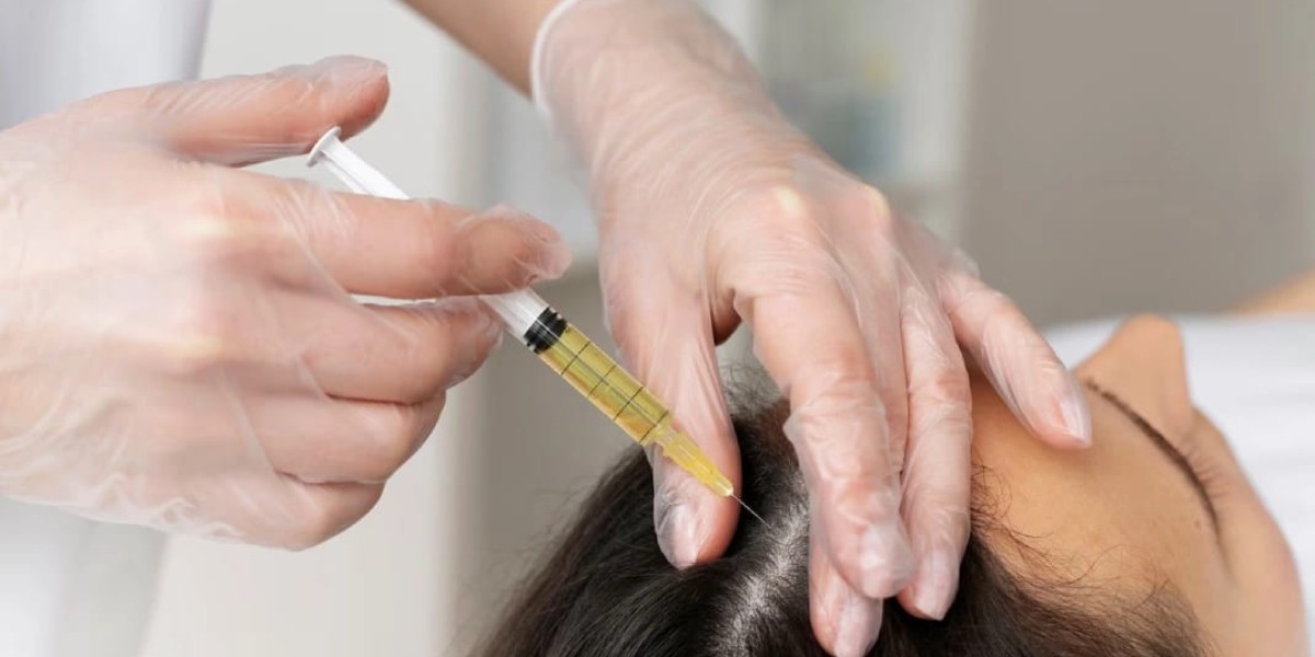 GFC Treatment: A Modern Approach to Hair Loss