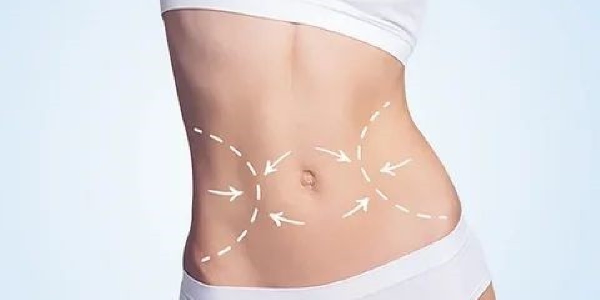 Liposuction Preparation: Lifestyle and Care Before Your Procedure