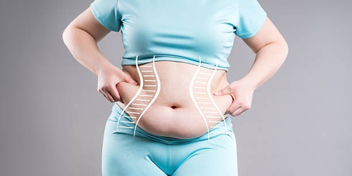 Thigh Liposuction: Benefits, Process, and Recovery